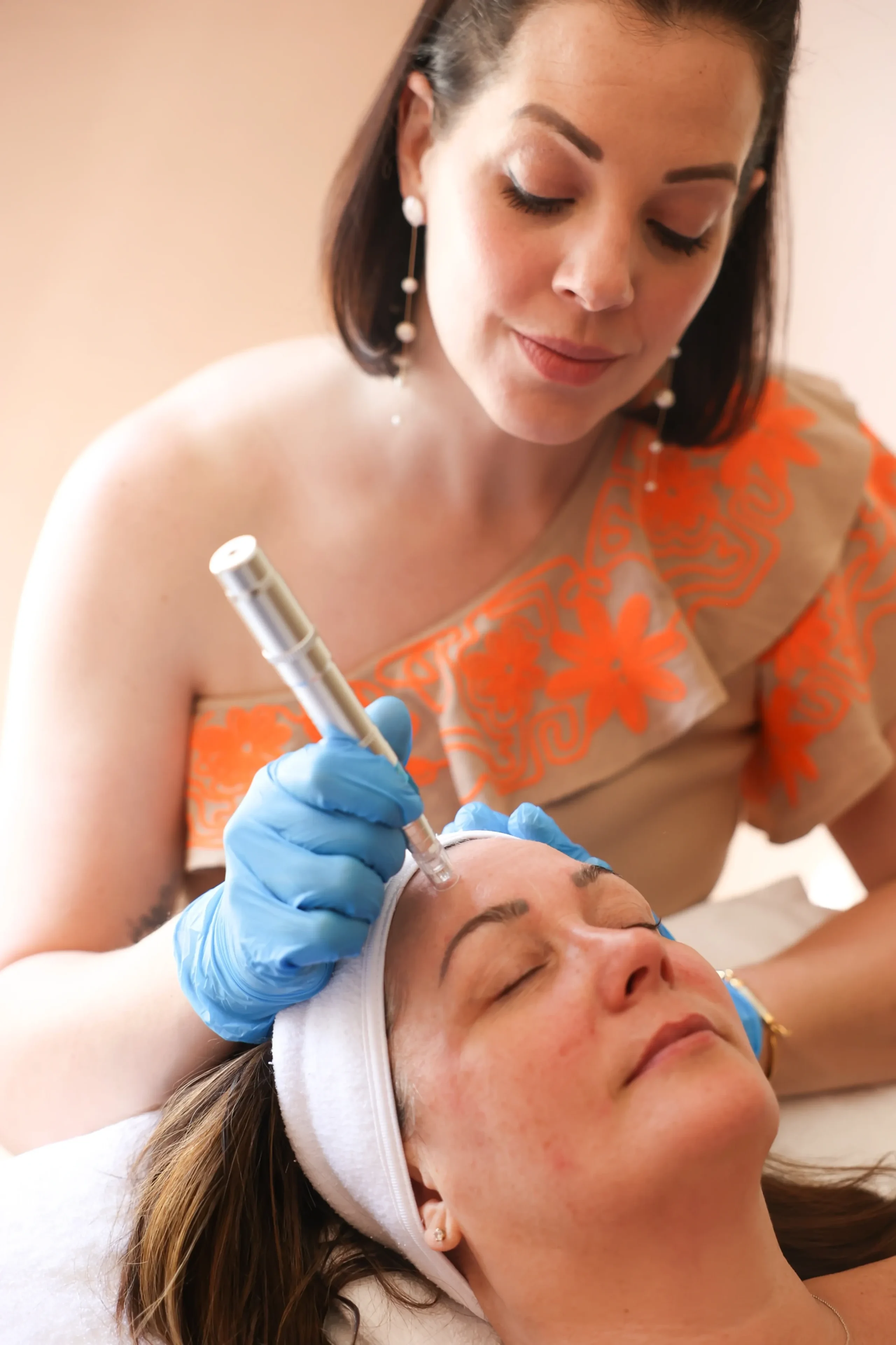 Acupuncture Concord Ca